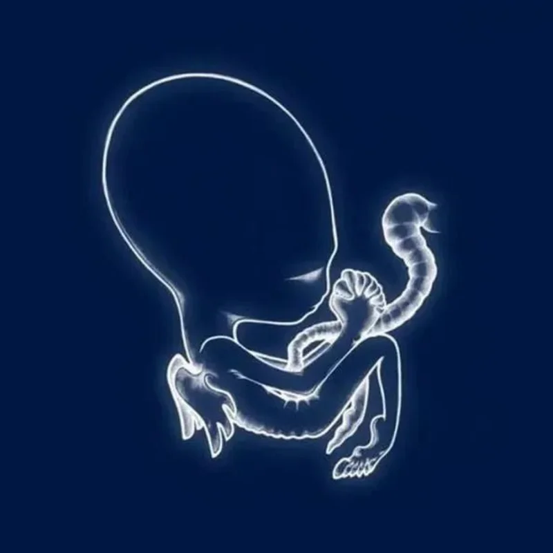 Sigur Rs - gtis Byrjun - Vinyl Record 2LP