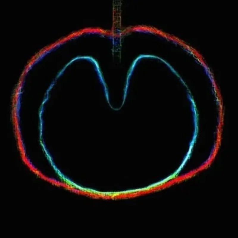 XTC - Wasp Star - Apple Venus Volume 2 - Vinyl Record LP 200g Import